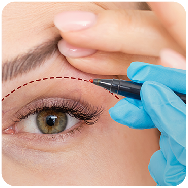 Eyelid lift, Al Safwa Hospital, Riyadh