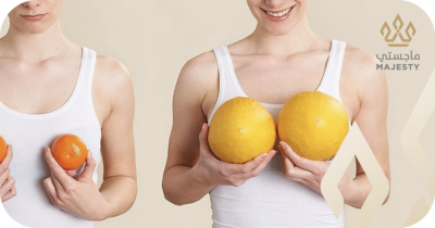 كيف تتم عملية تكبير الصدر: خطوات الجراحة بالتفصيل