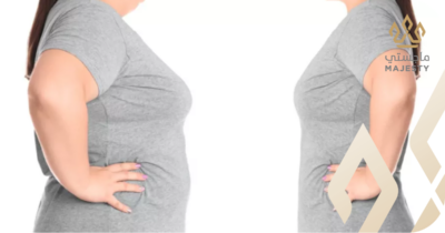 نصائح بعد عملية نحت الجسم