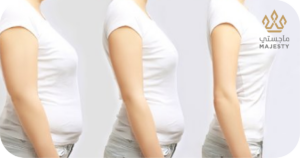 نصائح بعد عملية نحت الجسم