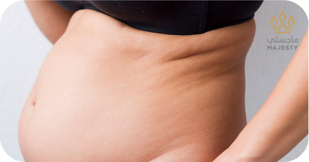 شد البطن بعد سن اليأس: خطوات فعالة