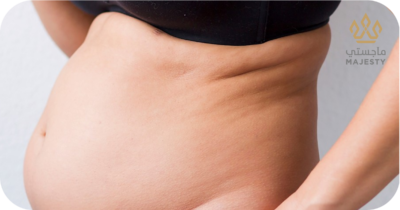 شد البطن بعد سن اليأس: خطوات فعالة