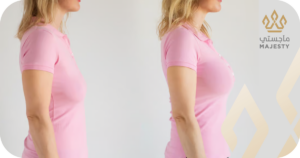 عوامل اختيار حجم الثدي المناسب