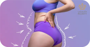 التحكم في الوزن للحفاظ على نتائج التكبير