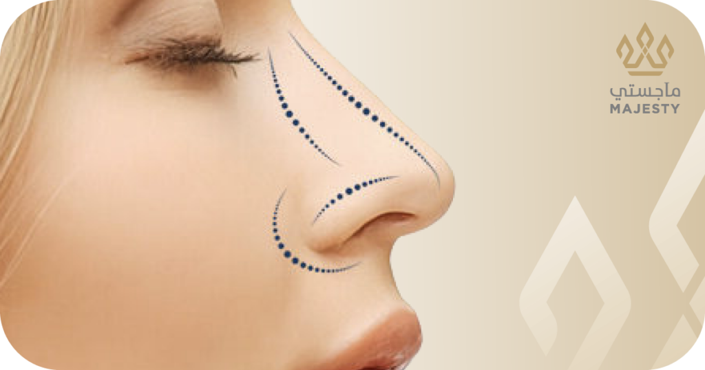 تعرفي على مراحل تجميل الانف بالتفصيل: خطوات العملية والنتائج