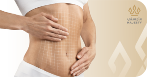 نصائح بعد عملية شد البطن