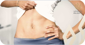 تجربتي مع عملية شد البطن