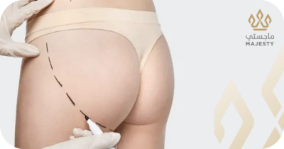 تجاربكم مع عمليات تكبير الأرداف: قصص واقعية ونصائح عملية