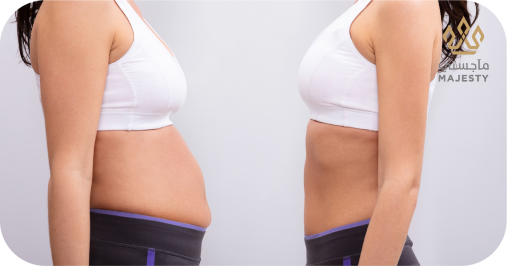 كيف تحافظين على نتائج عملية نحت الجسم لأطول فترة ممكنة: تعرفي إلى أهم النصائح