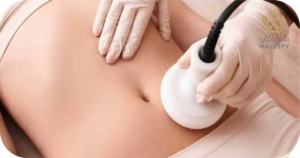 نتائج شفط البطن بالفيزر مقارنة بالليزر