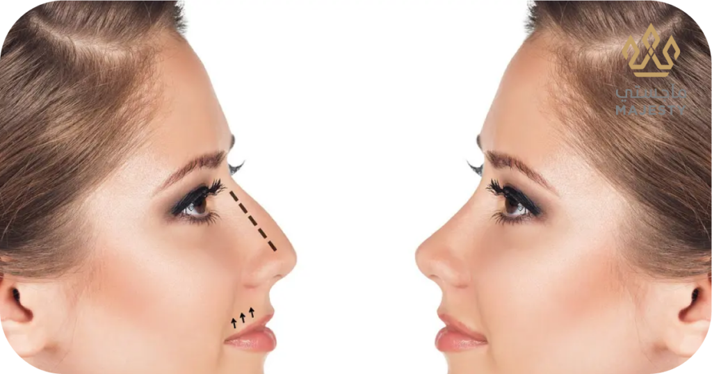 كيف تحافظين على نتائج عملية تجميل الأنف لأطول فترة ممكنة