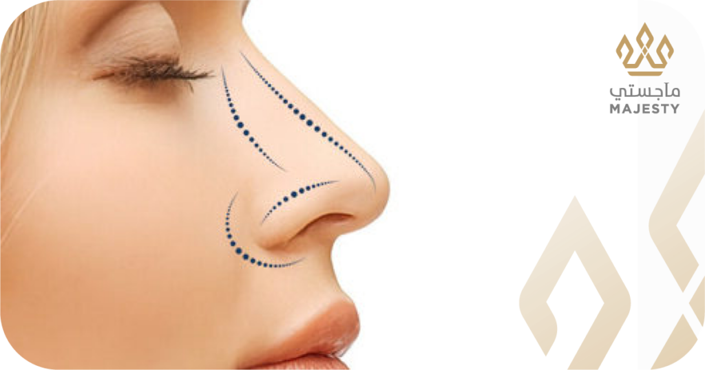 نسبة نجاح عملية تجميل الأنف: ما هي أهم العوامل المؤثرة؟