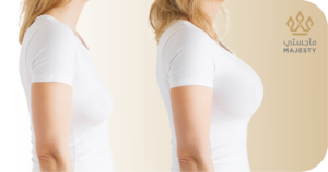 تكلفة تكبير الثدي في الرياض