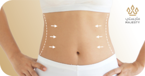 أفضل دكتور شفط دهون البطن في الرياض