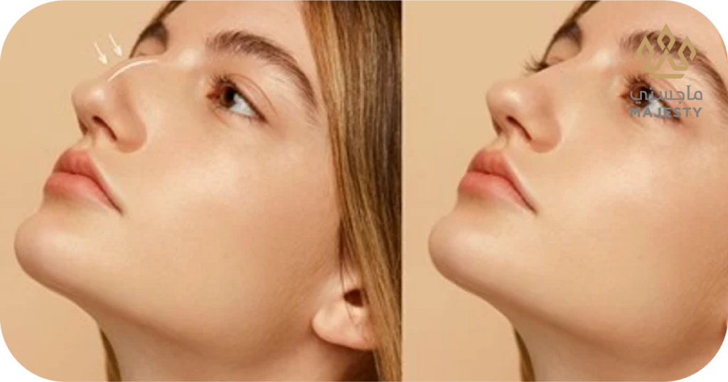 سعر عملية تجميل الانف: التكاليف وأهم العوامل المؤثرة