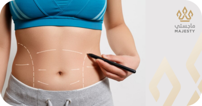 بدائل شفط دهون البطن: خيارات فعالة وآمنة