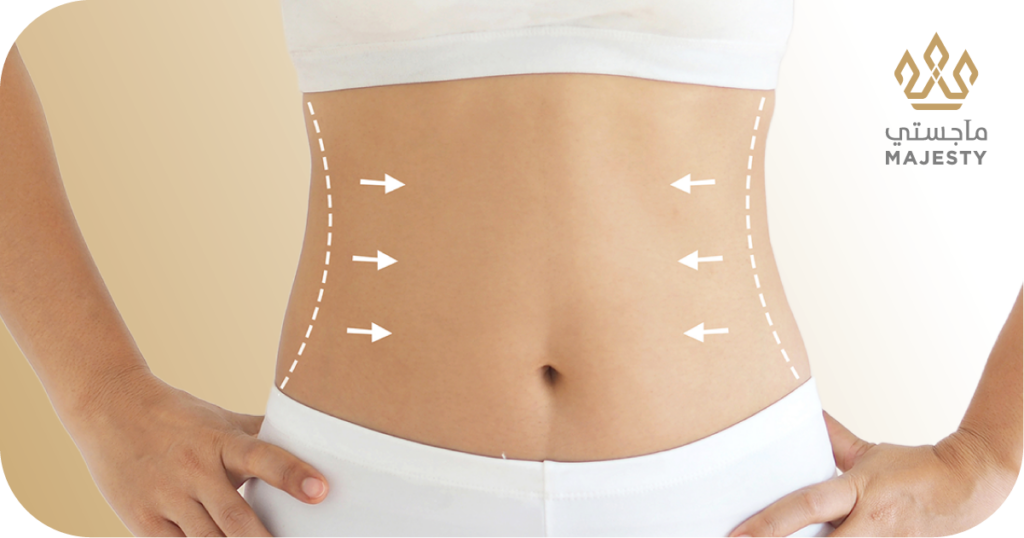 كيف تحافظين على نتائج عملية شفط دهون البطن لأطول فترة ممكنة
