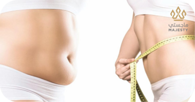 هل نحت الجسم دائم؟ اكتشفي الحقيقة الآن