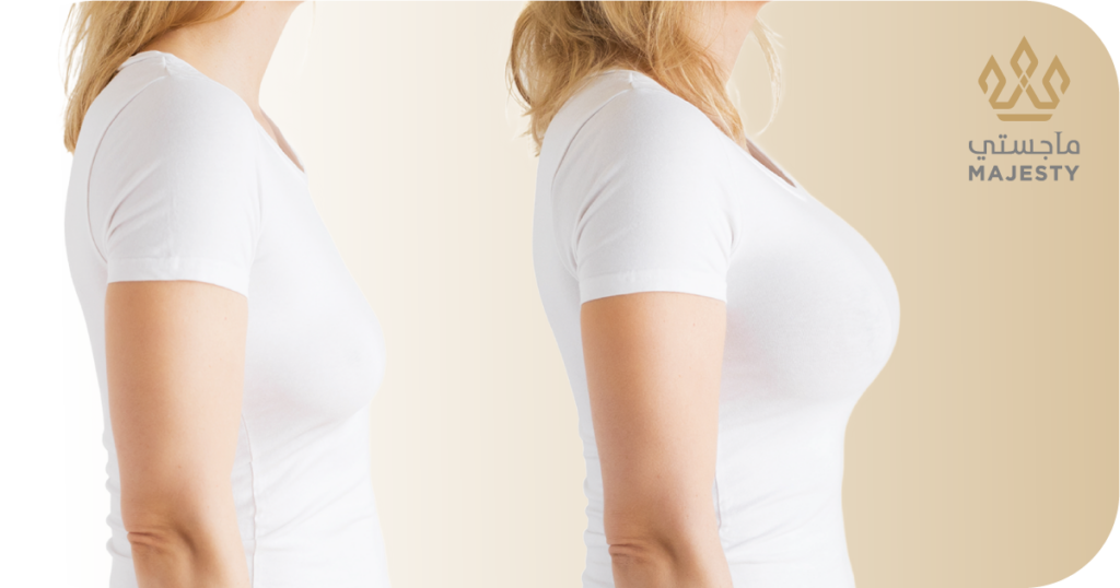 تكبير الصدر بدون جراحة: طرق طبيعية وآمنة