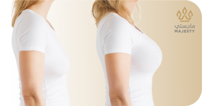 تكبير الصدر بدون جراحة: طرق طبيعية وآمنة