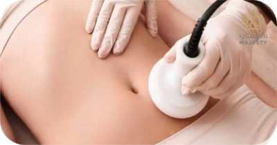 نحت الجسم بالكرايو: تخسيس فعال وآمن للجسم