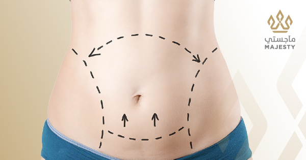 عملية شد البطن المصغرة: التكلفة، المزايا، وأهم المعلومات