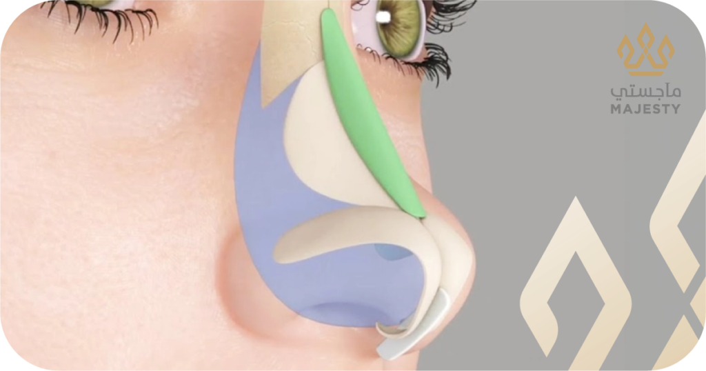 تجميل الأنف ثلاثي الأبعاد: كل ما تحتاجين معرفته