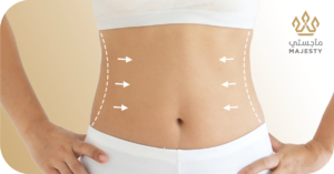 التعافي بعد عمليات الفتق وشد البطن