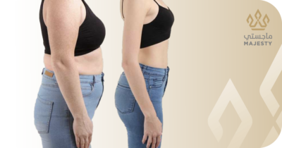 فوائد نحت الجسم: دليل شامل لتحقيق الشكل المثالي