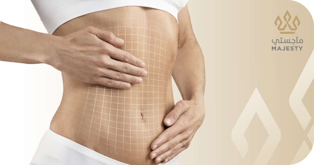 تجربتي مع عملية نحت الجسم: التحضير، يوم العملية، والنتائج بعد شهرين