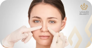 جراحة تجميل الأنف المفتوحة مقابل المغلقة