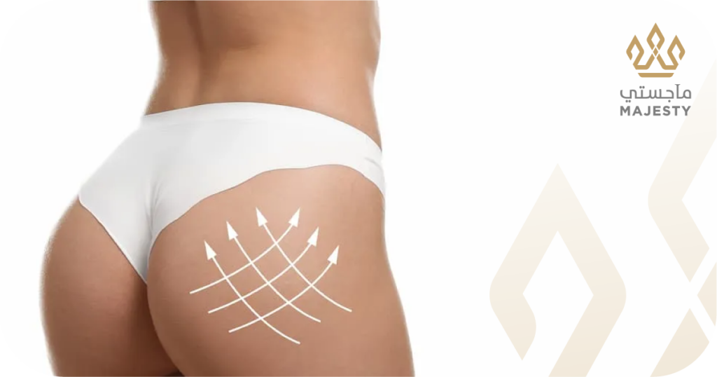 هل عملية تكبير الأرداف دائمة؟ التفاصيل هنا