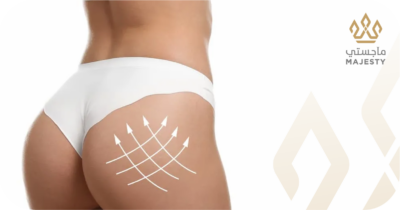 هل عملية تكبير الأرداف دائمة؟ التفاصيل هنا