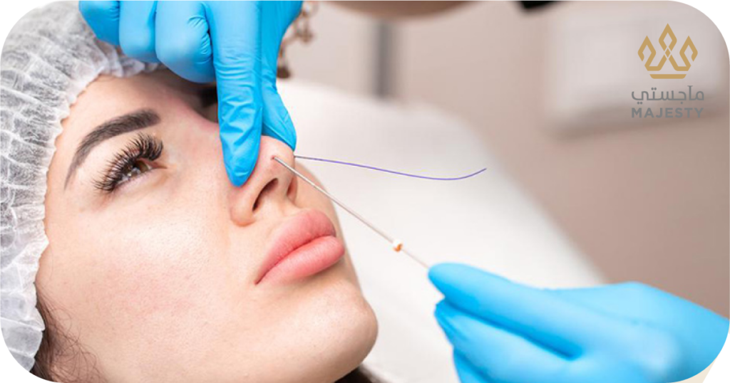 أسرار تجميل الانف بالخيوط: نتائج مذهلة بدون جراحة