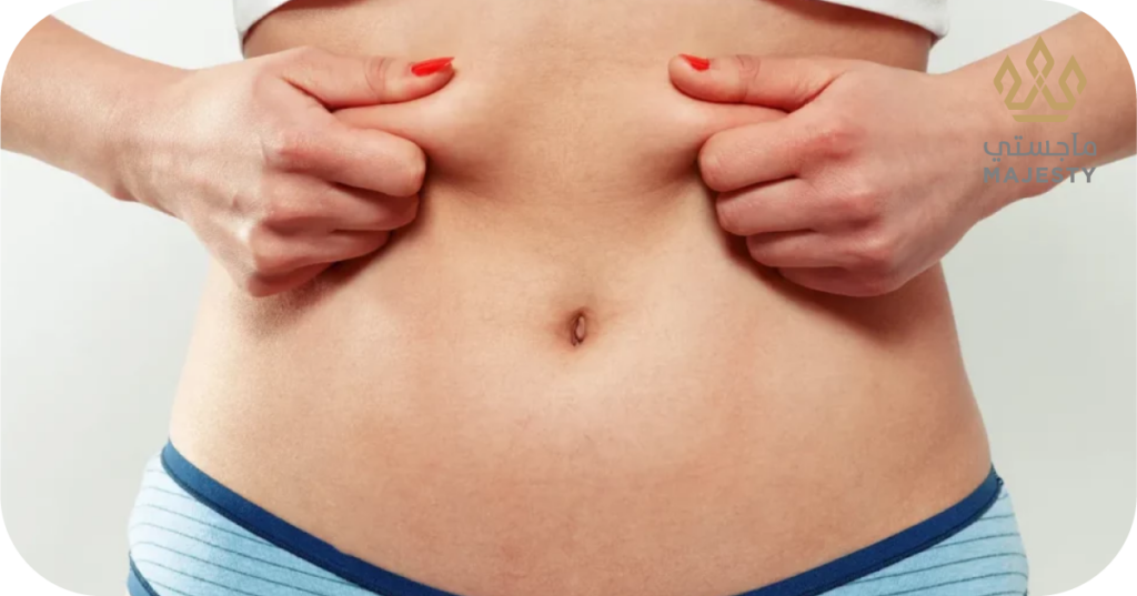 ما أسباب تحجر البطن بعد شفط الدهون؟