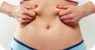 ما أسباب تحجر البطن بعد شفط الدهون؟