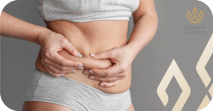 نصائح للوقاية وتقليل تحجر البطن بعد شفط الدهون