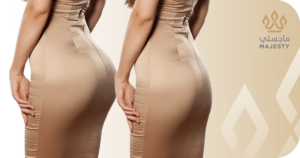 سعر عملية تكبير المؤخرة