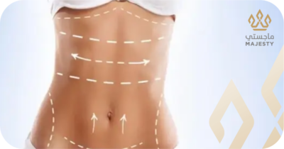 كم جلسة نحت الجسم تحتاجين لتحقيق النتائج المثالية