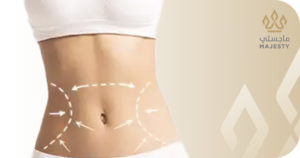 كل ما تحتاج معرفته عن النحت الرباعي بدون جراحه