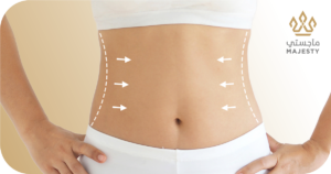 تكلفة شفط دهون البطن