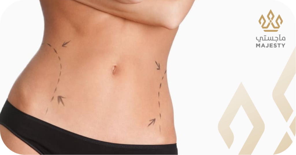 نسبة نجاح عملية شد البطن وعواملها الأساسية