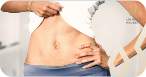 المدة اللازمة لشد البطن بعد التكميم