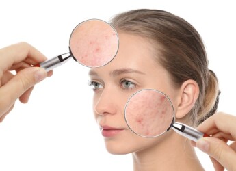 جهاز البيكو- واي للتصبغات