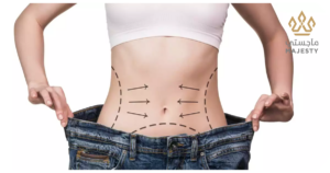 النتائج المتوقعة من شفط دهون البطن بالموجات فوق الصوتية