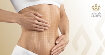 شفط دهون البطن: خطوات العملية وأهم المعلومات التي تحتاجها