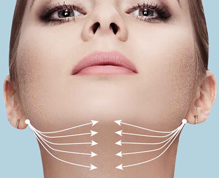 إجراءات عملية شفط الذقن المزدوج