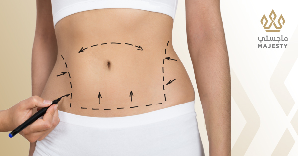 عملية شد البطن: فوائدها، مخاطرها، وتكاليفها