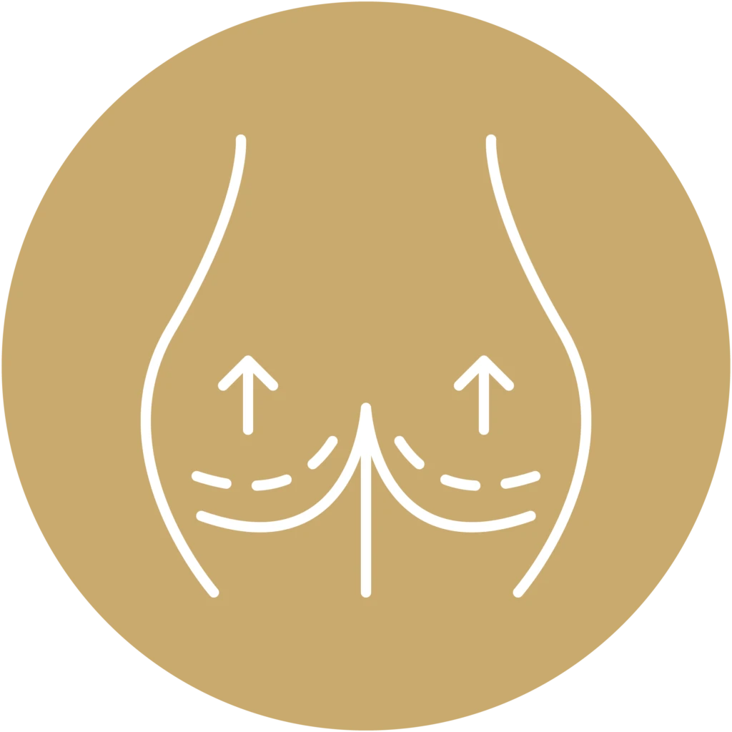 تكبير الأرداف