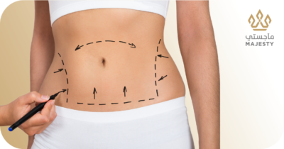 شد البطن الكامل أم المصغر: نصائح لاتخاذ القرار الصحيح